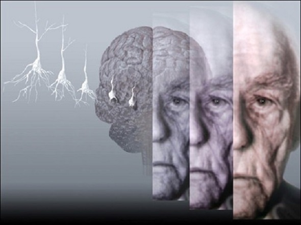 Investigadores argentinos hallaron una clave del origen del Alzheimer