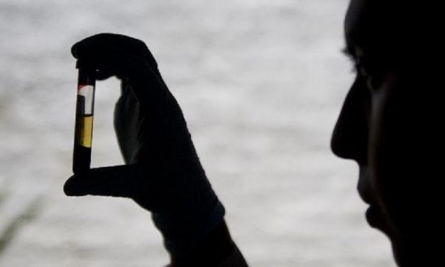 Una nueva prueba de detección precoz de cáncer de páncreas fue creada