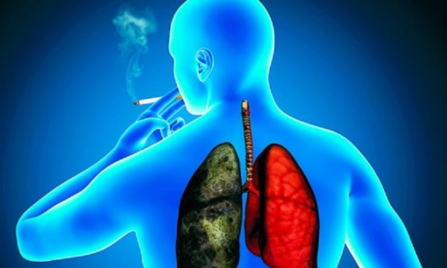 El de pulmón es el cáncer que más mata en el mundo