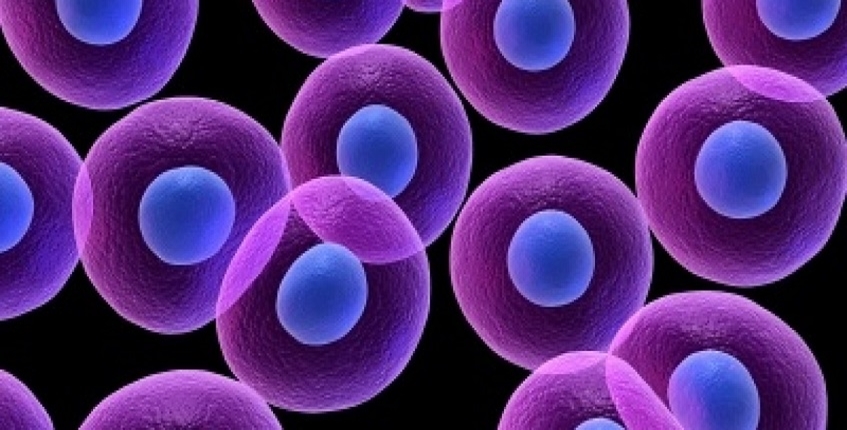 Las células inmunes tomadas de alguien sano pueden ser usadas para batallar el cáncer en otra persona
