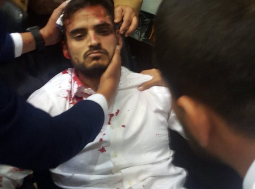 Venezuela: diputados heridos por un ataque de civiles armados contra el Parlamento