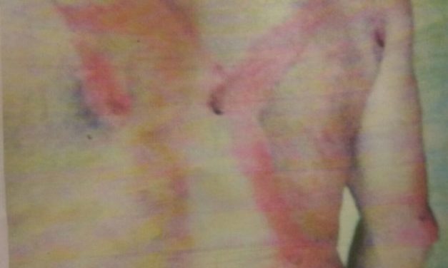 El PIT-CNT le pagará un abogado al trabajador rural golpeado por su empleador