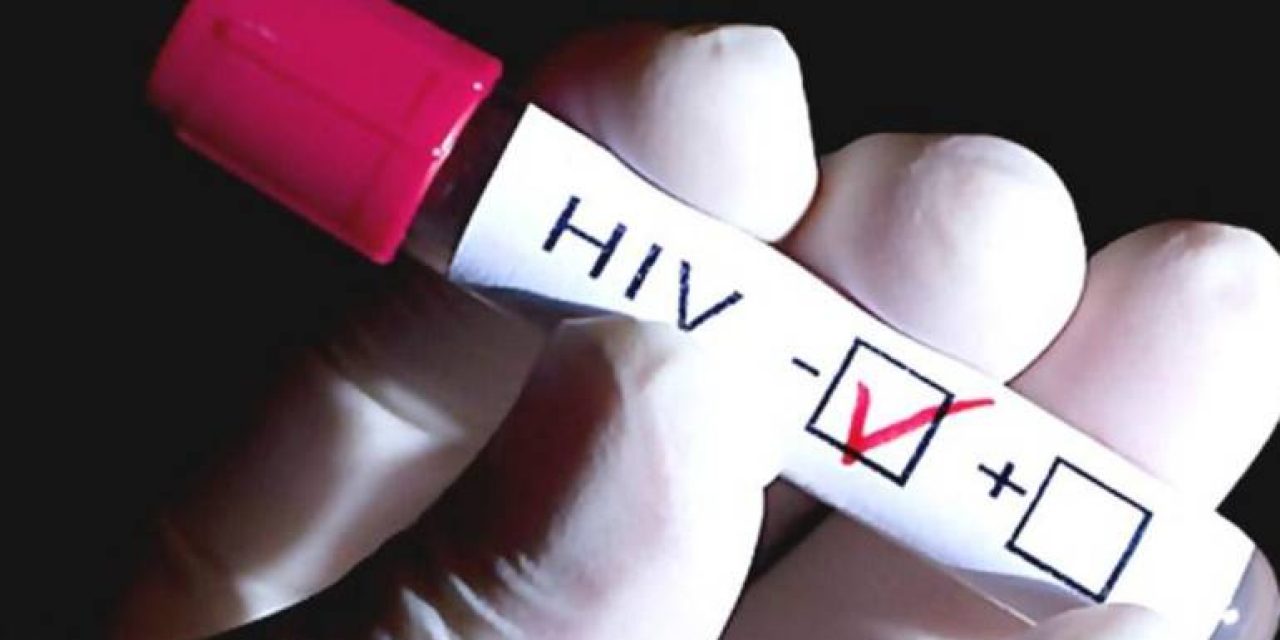 «Se debe mejorar el acceso a test rápido de VIH»