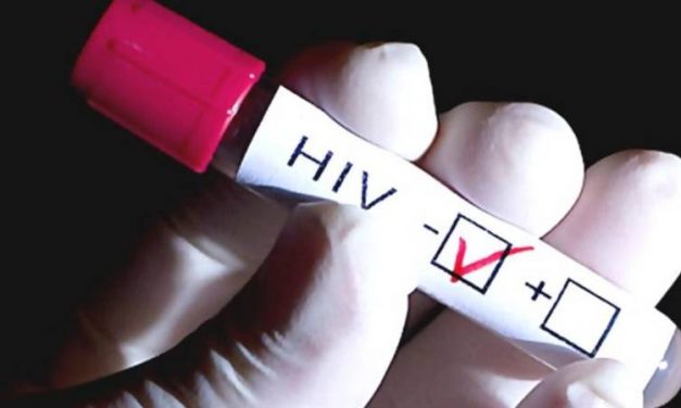 «Se debe mejorar el acceso a test rápido de VIH»