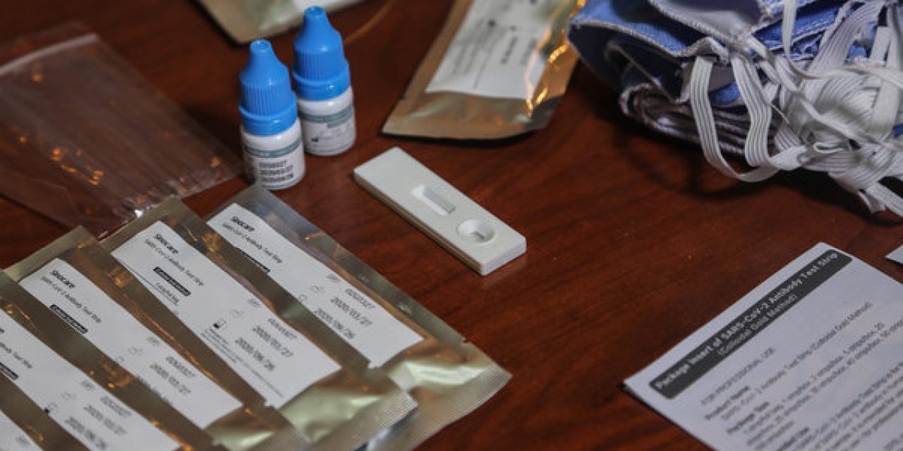 Convocan a empresas nacionales a producir envases para kits de hisopado