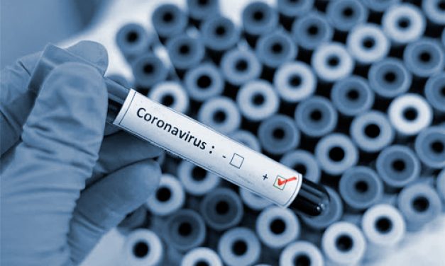 Se detectaron 19 casos positivos nuevos de Coronavirus COVID-19 en Uruguay