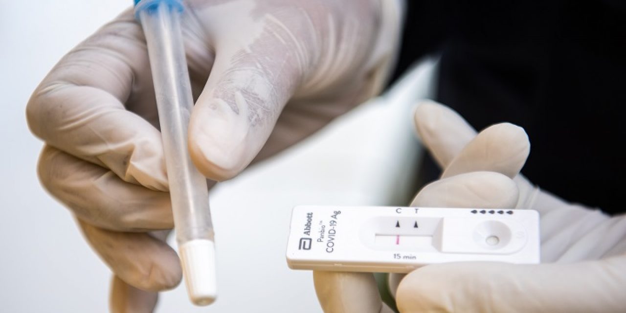 MSP recomienda Test Antigénicos como primera opción para detectar  SARS – CoV – 2