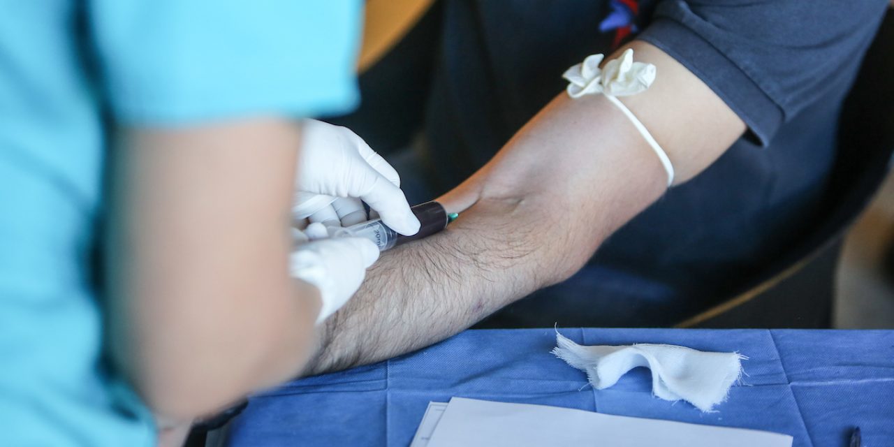 Hepatitis C en Uruguay con mayor tasa de mortalidad que el VIH