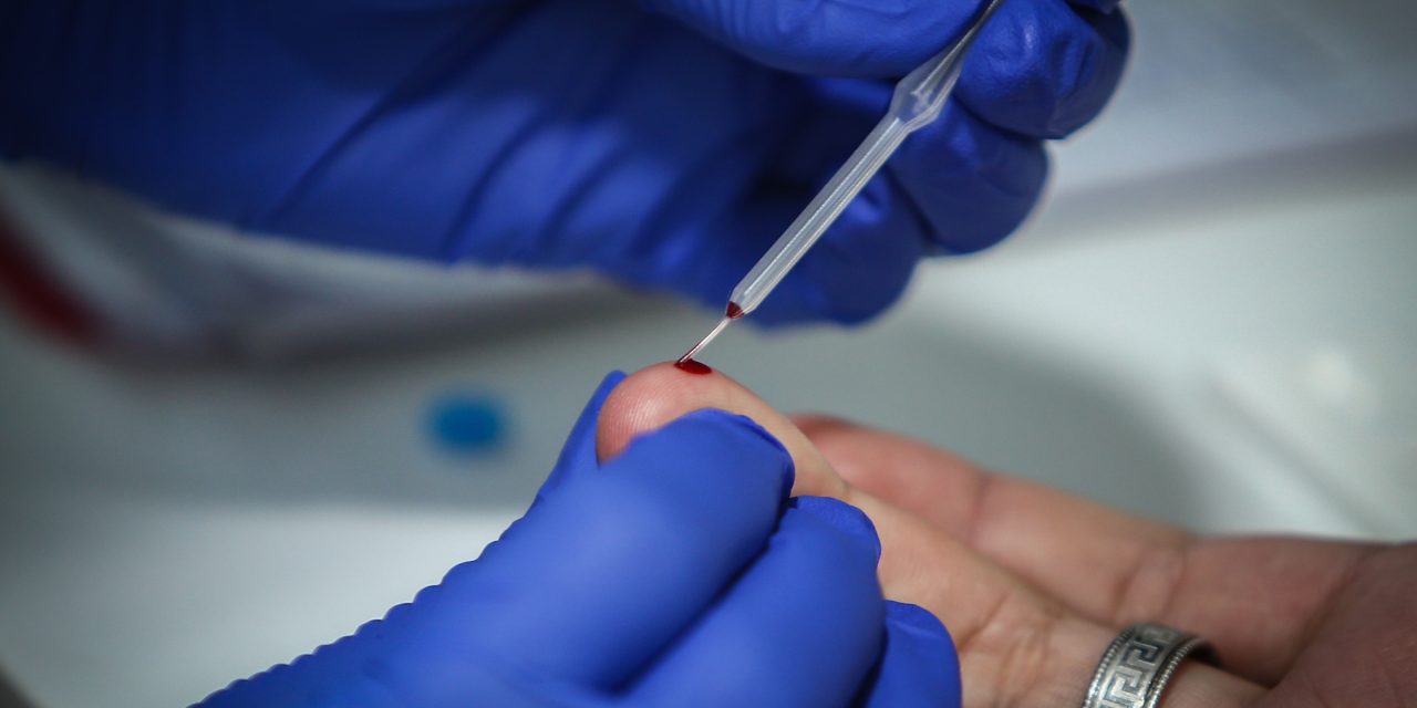 Este lunes harán test rápidos y gratuitos de detección de VIH en explanada de IMM